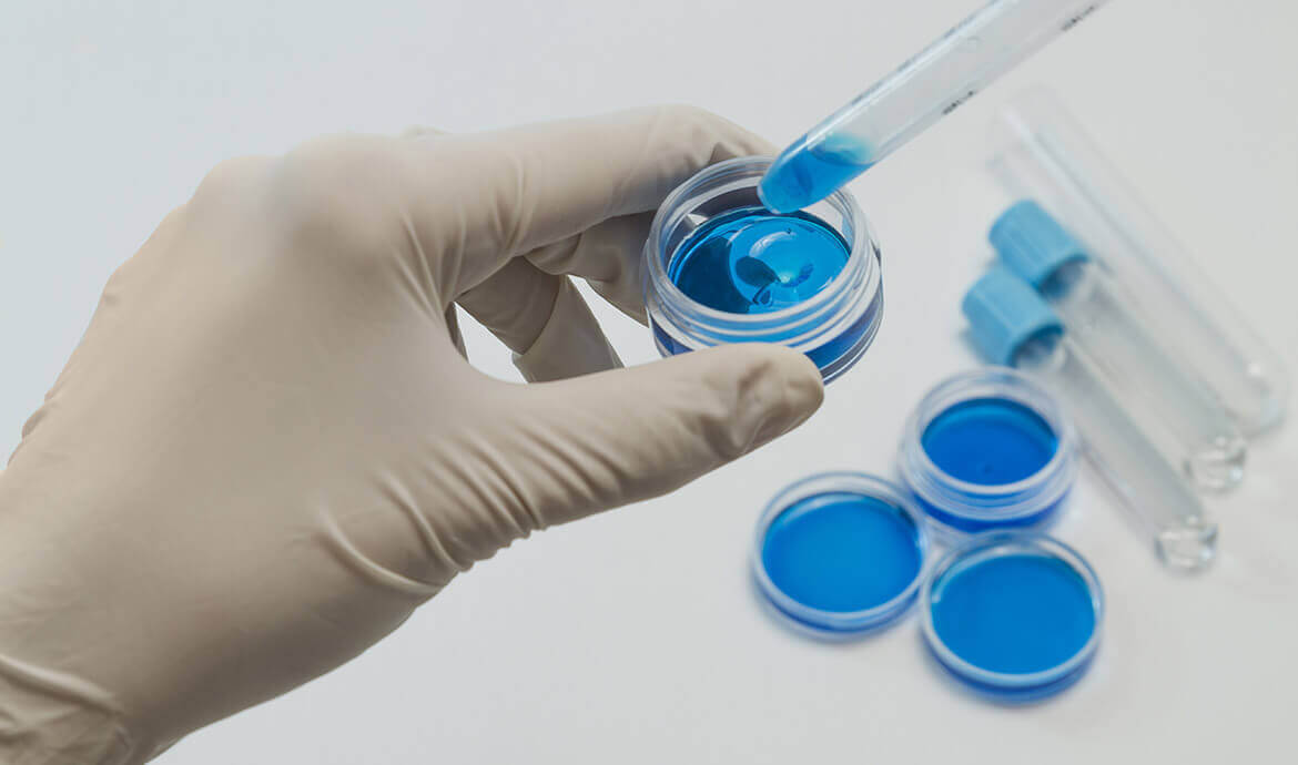 درمان‌های طبیعی برای کبودی‌ها